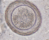 <p>roundworm most common found in wild species</p>