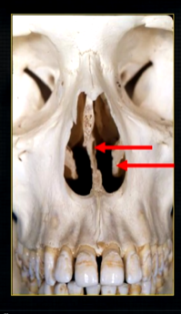 <p>what is seen here?</p>