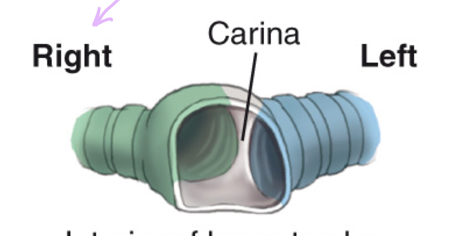 <p>Cartilaginous ridge at the tracheal bifurcation into right and left main bronchi (around T5).</p>