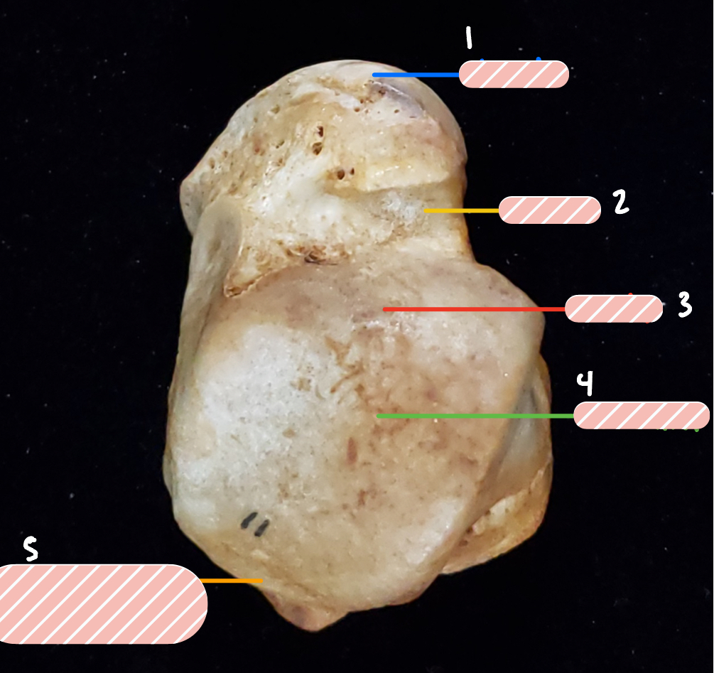 <p>What bone is this?</p>