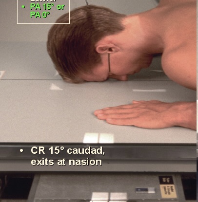<p>What position is this?</p>