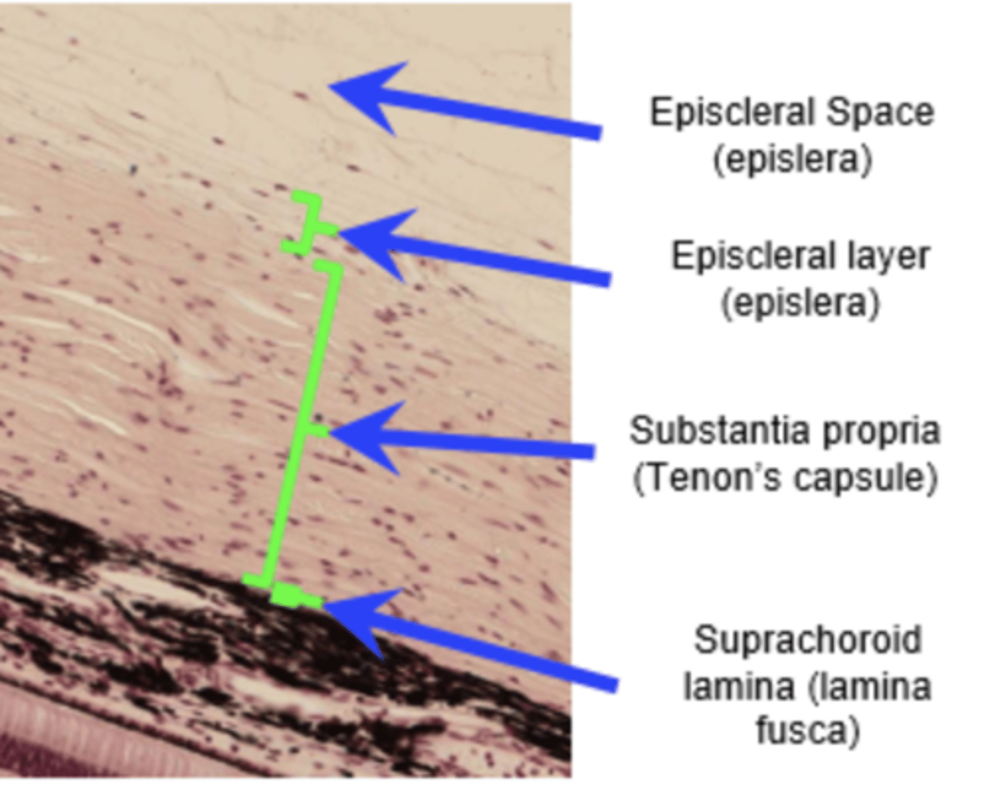 <p>What are the characteristics of the episclera? (3)</p>