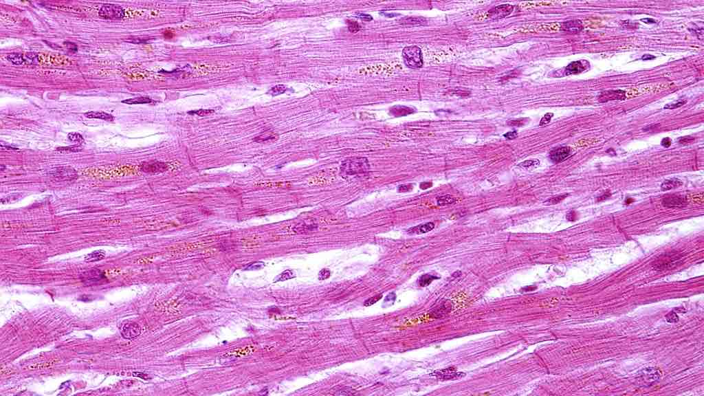 <p>cardiac muscle tissue</p>