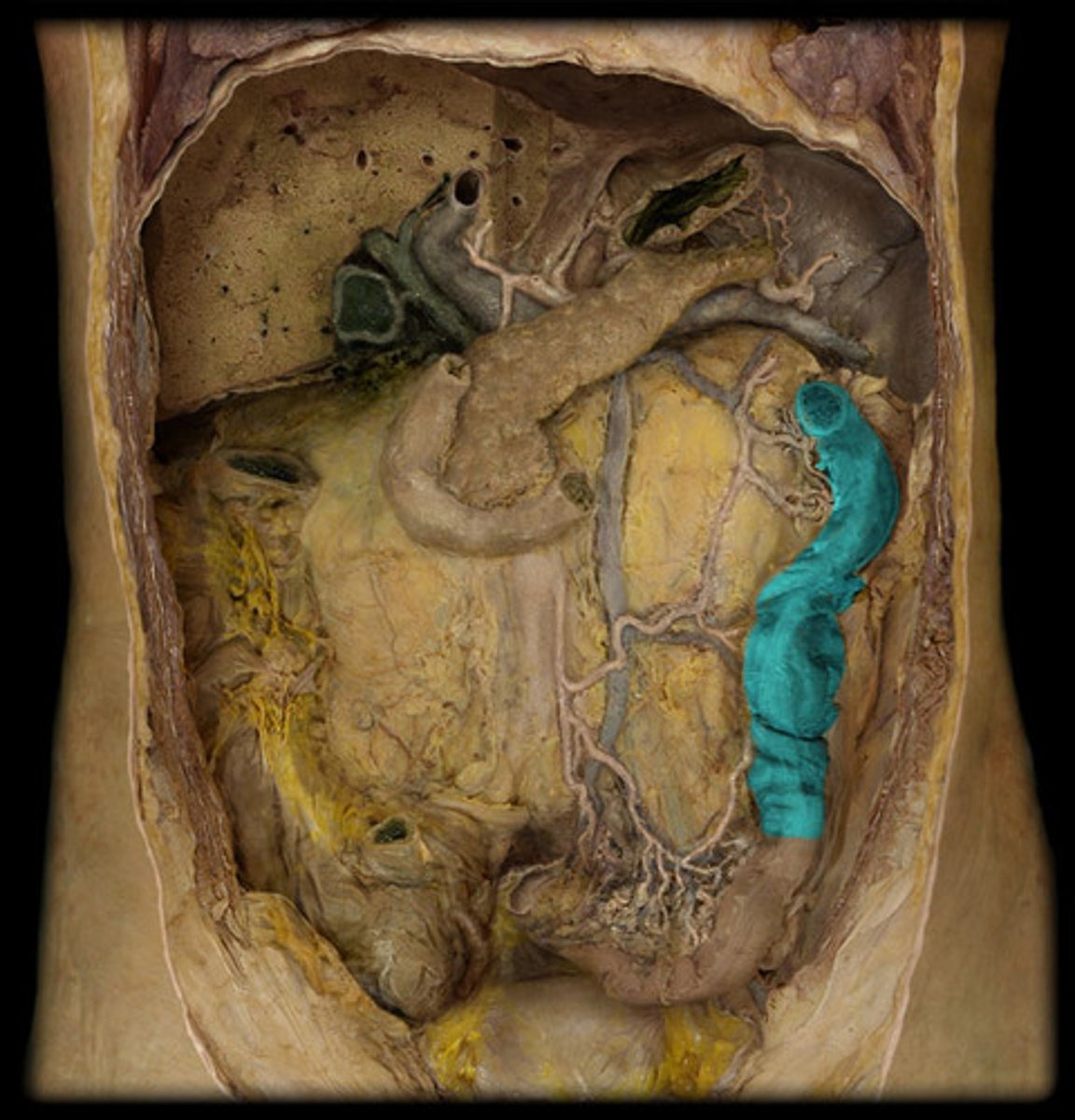 <p>portion of the colon that extends downward from the transverse colon</p>