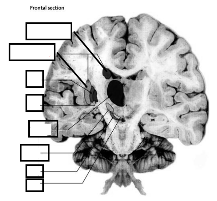 <p>Waaruit bestaan de basale ganglia? &amp; Duid ze aan</p>