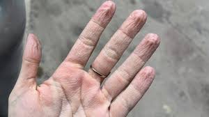 <p>Gramma fingers </p>