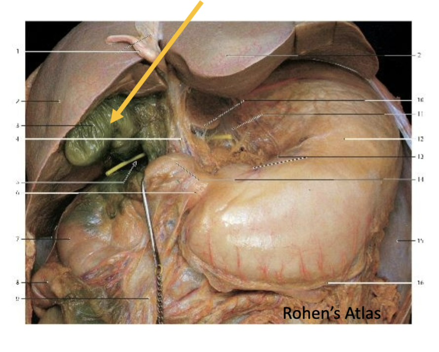 <p><span>Pain from inflammation of the tagged structure primarily passes through which of the following structures?</span></p>