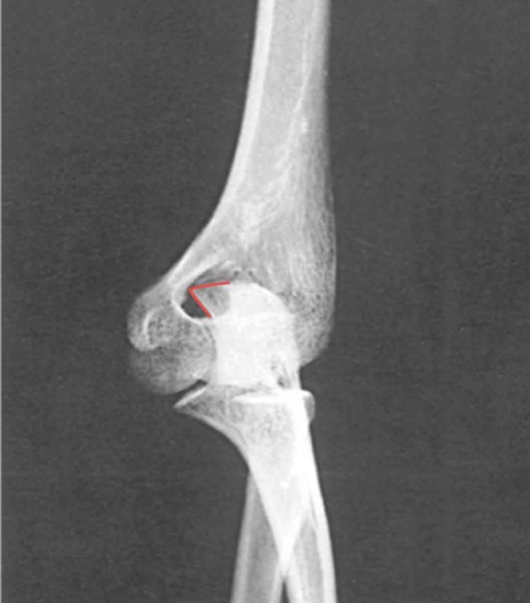 <p>What structure is highlighted?</p>