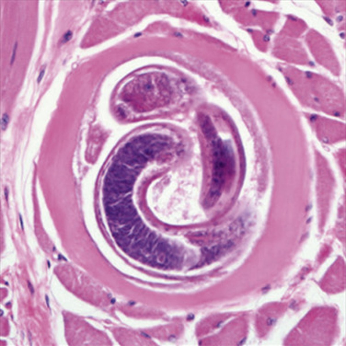<p>Spiral shape encapsulated larvae in muscle tissue</p>