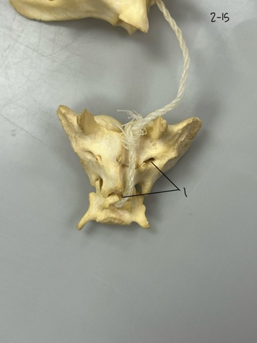 <p>Entire structure?</p>