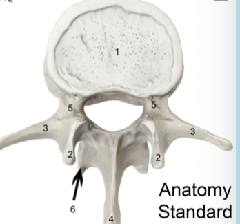<p>lumbar vertebrae</p>