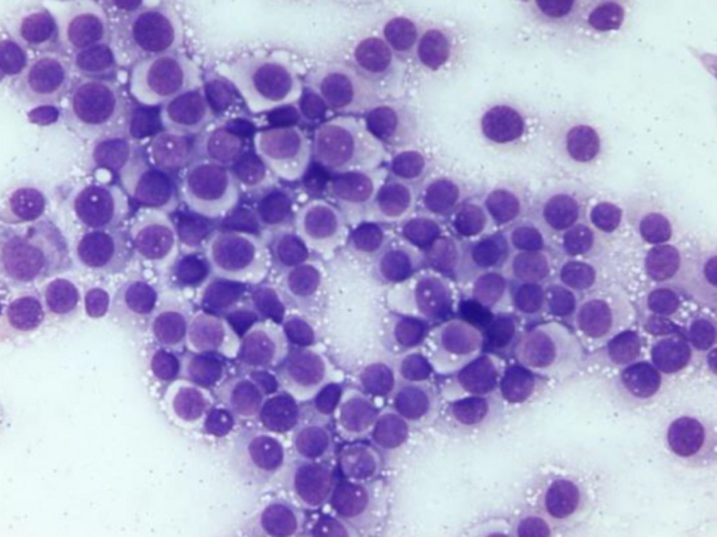 <p>Identify the type of round cell neoplasia?</p>