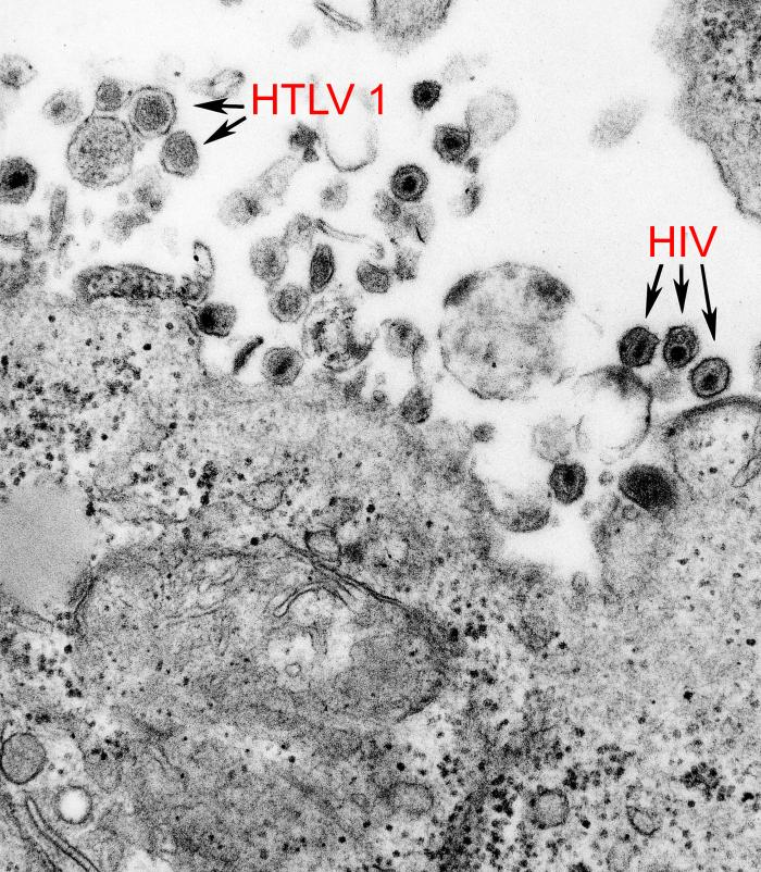 <p>human T-cell lymphotropic virus (HTLV-1)</p>