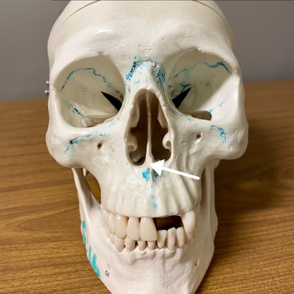 <p>What bone is this?</p>