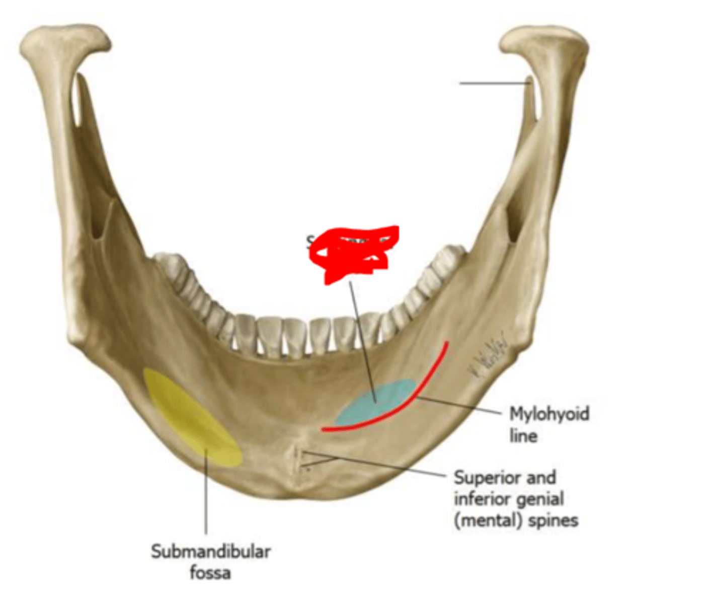 <p>above mylohyoid line</p>