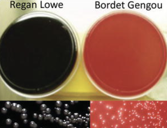 <p>Temp: 35-37C</p><p>Media: Bordet-gengou or Regan-Lower</p><p>Appearance: Mercury Droplets</p><p></p>