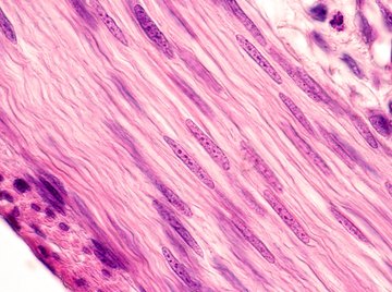 what type of tissue does this picture show