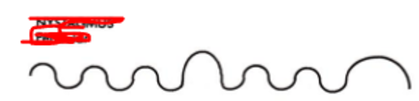 <p>nystagmus where the eyes move equally in both directions. Foveal fixation occurs at the peak of the waveform where eye velocity is slowest. Typically seen for congenital cases of nystagmus.</p>