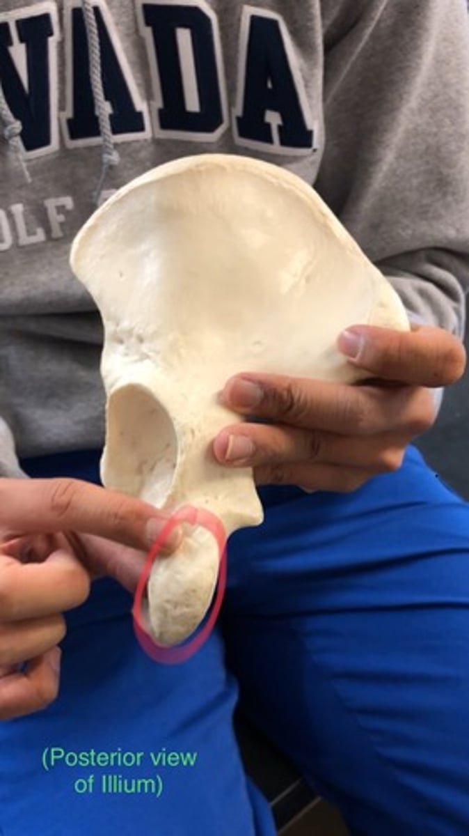 <p>rough patch; below the lesser sciatic notch (what you feel when you sit)</p>