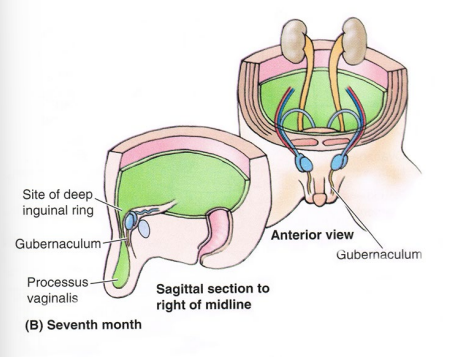 <p><strong>Inguinal Canal Development</strong></p><p>-_______ descend from posterior abdominal wall → _______ in males </p><p>-Inguinal canal created by processus ________ → normally closes a few weeks before or few weeks after birth. ______ area in males, which is why inguinal hernias happen </p>