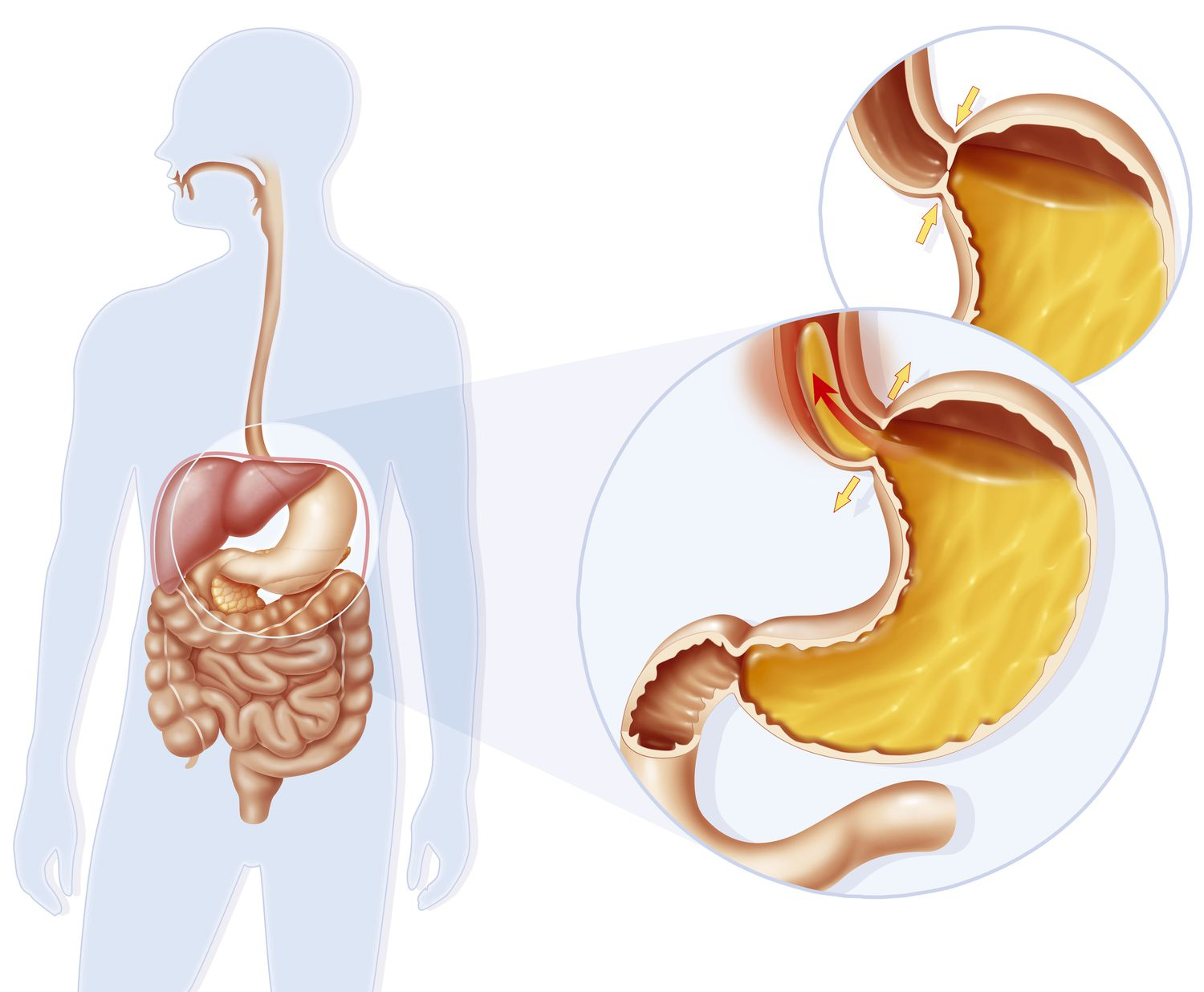 <p>What is a sphincter?</p>