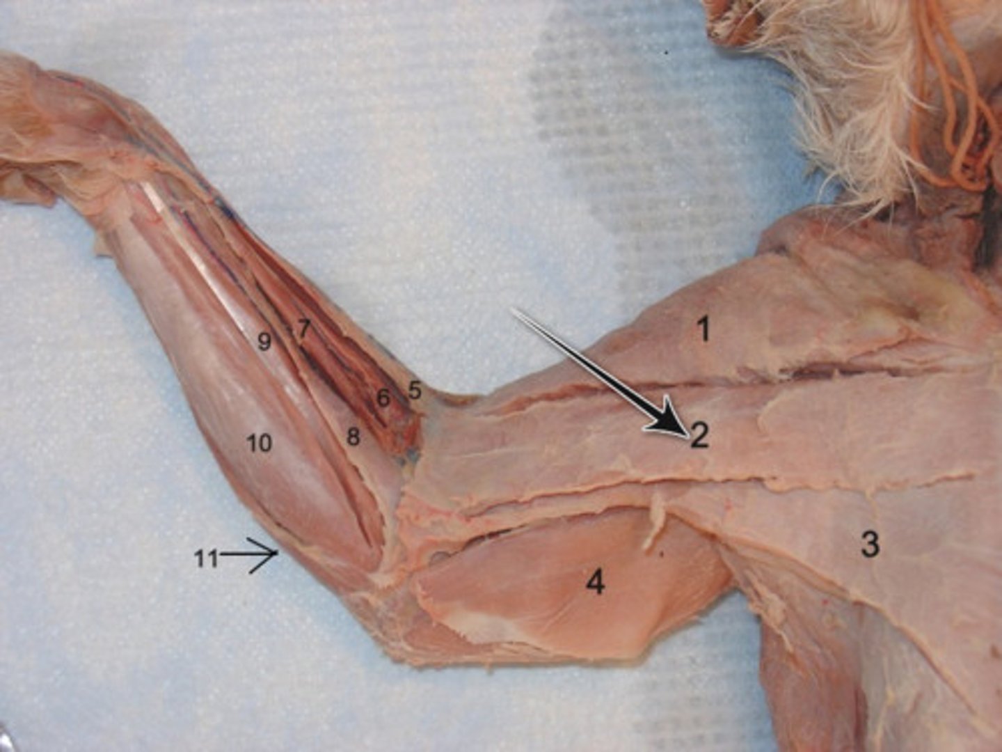 <p>-not in man</p><p>-originates- anterior part of sternum</p><p>-inserts- fascia of ulna</p><p>-narrow band across chest</p><p>-means: chest armpit arm</p><p>-function: draws forelimb to midline</p>