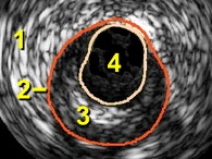 term image