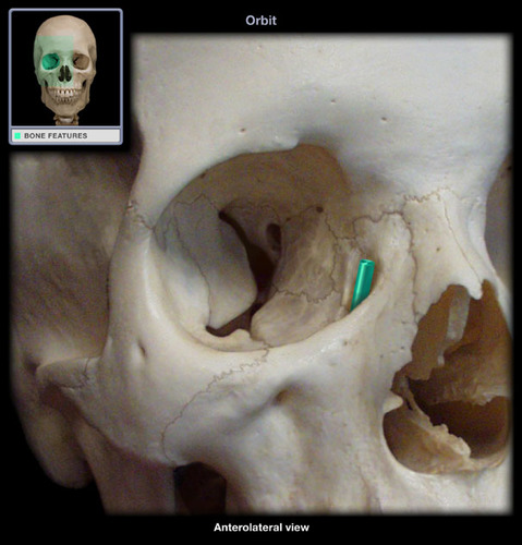 depression formed by the maxillary & lacrimal bones the is bounded by the anterior & posterior lacrimal crests; contains the lacrimal sac