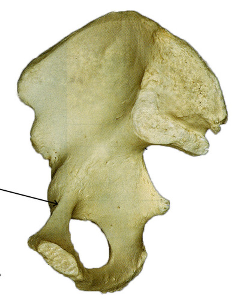 <p>ridge on top of pubis, continuation from the arcuate line</p>