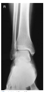 <p>What ankle view is this?</p>