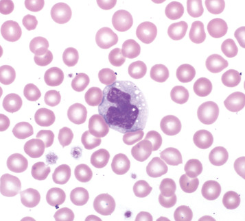 <p>What type of WBC is this?</p>
