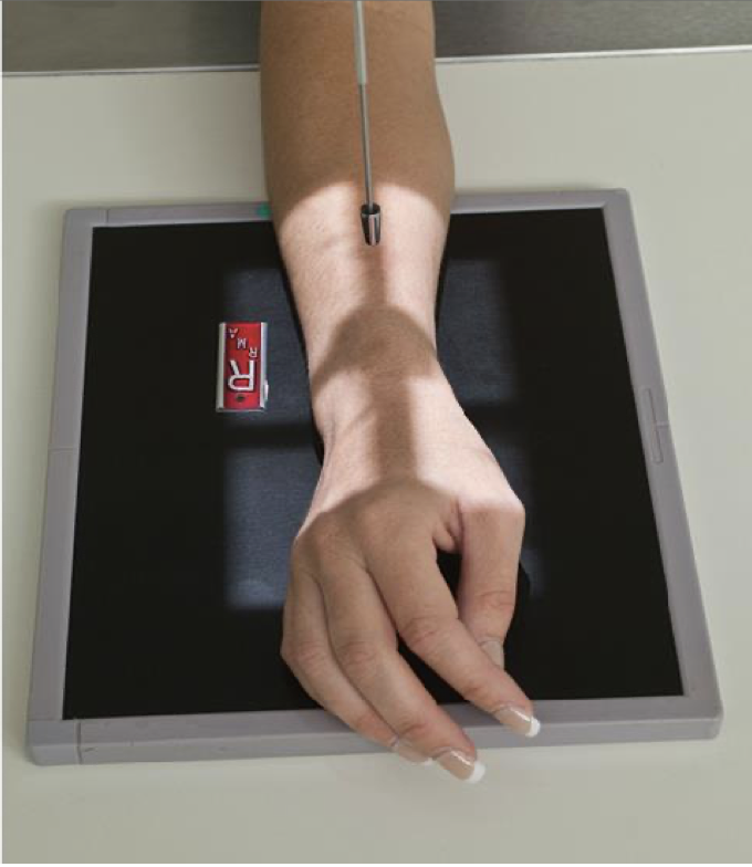 <p>Patient Position</p><ul><li><p>Same as PA Wrist</p></li></ul><p>Part Position</p><ul><li><p><span style="line-height: normal;"> </span>Hand is pronated and wrist is rotated 45<span style="line-height: normal;"> o </span>laterally</p></li><li><p class="p1"><span style="line-height: normal;"> </span>Thumb side “up”</p></li><li><p class="p1"><span style="line-height: normal;"> </span>Hand should be arched slightly</p></li><li><p class="p1"><span style="line-height: normal;"> </span>Long axis of 3<span style="line-height: normal;">rd</span> metacarpal in line with long axis of forearm</p></li></ul><p class="p1">CR</p><ul><li><p class="p1">Centered to mid-carpal region</p></li></ul><p class="p1">Collimation</p><ul><li><p class="p1">Same as PA Wrist</p></li></ul><p></p>