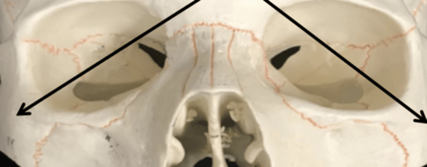 <p>zygomatic bone</p>