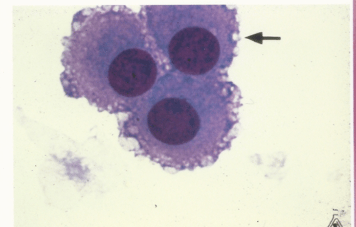 <p>Identify the cells in this body fluid</p>