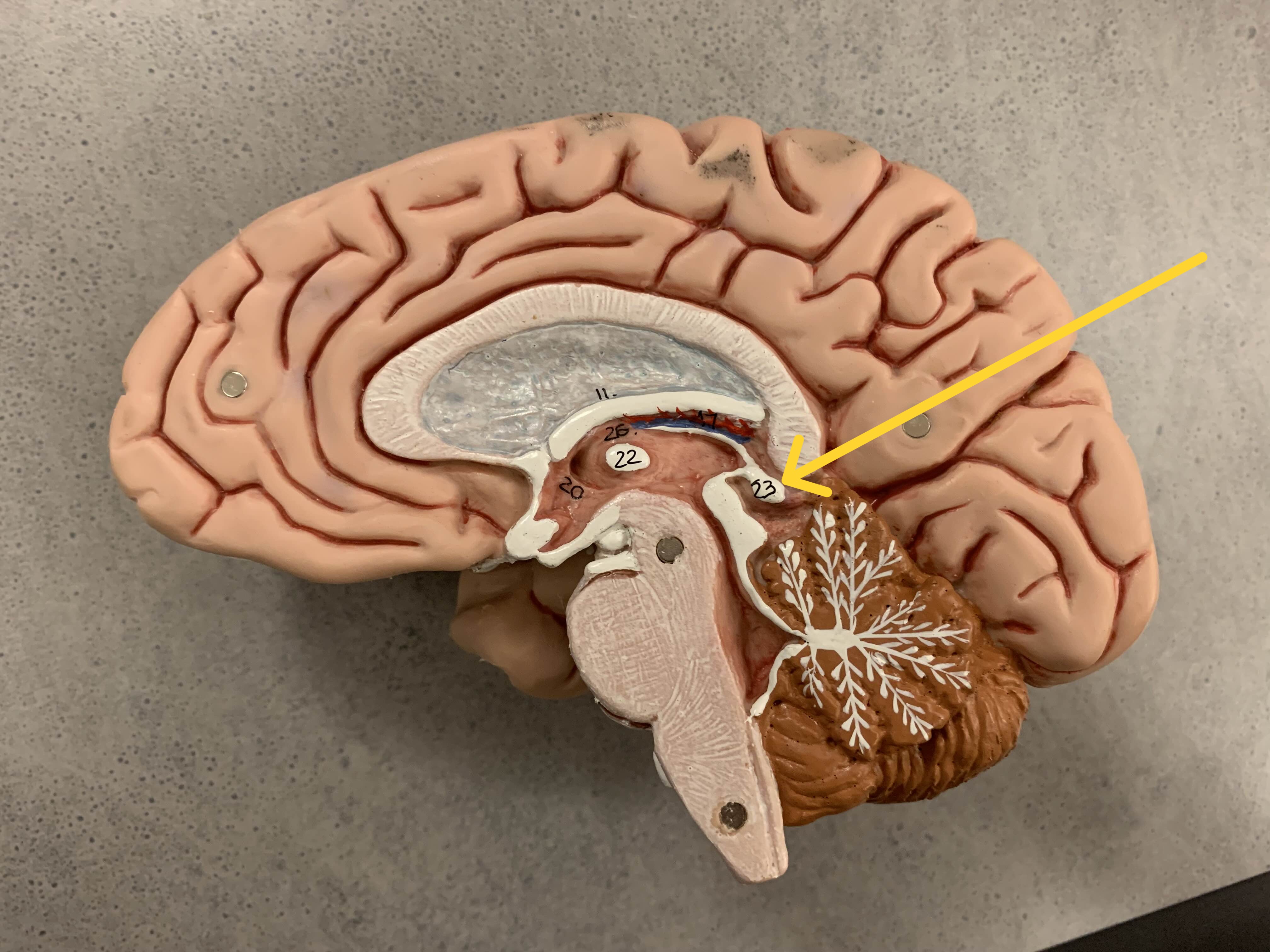 <p>Which part of the brain is:</p><ul><li><p>Behind third ventricle</p></li><li><p>Above the superior colliculus</p></li></ul><p></p>