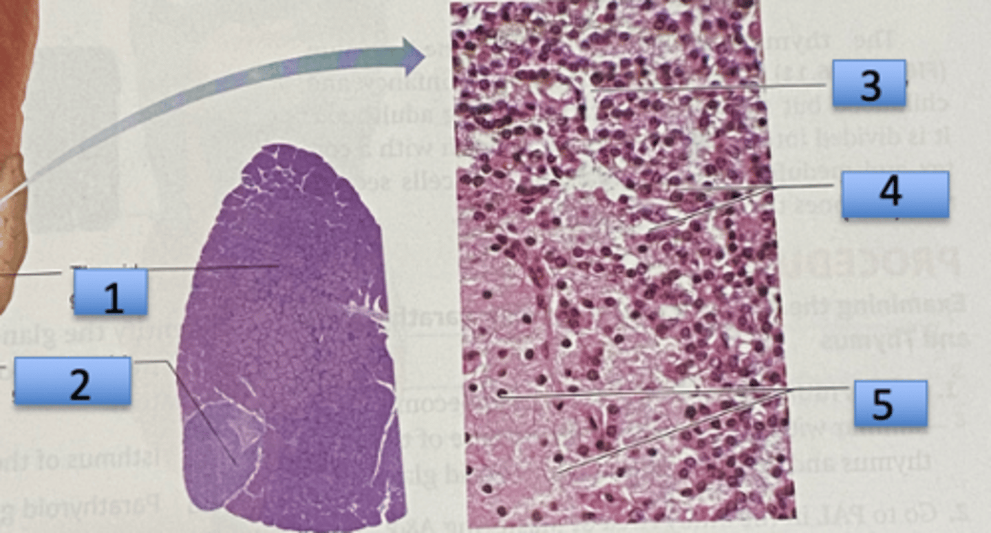 <p>Left picture</p><p>1. Thryoid gland</p><p>2. parathyroid gland</p><p>3. Capillary</p><p>4. Parathyroid (chief) cells</p><p>5. Oxyphil cells</p>