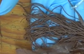 <p>A bundle of nerve roots located distal to the conus medullaris, translating to "horse's tail."</p>