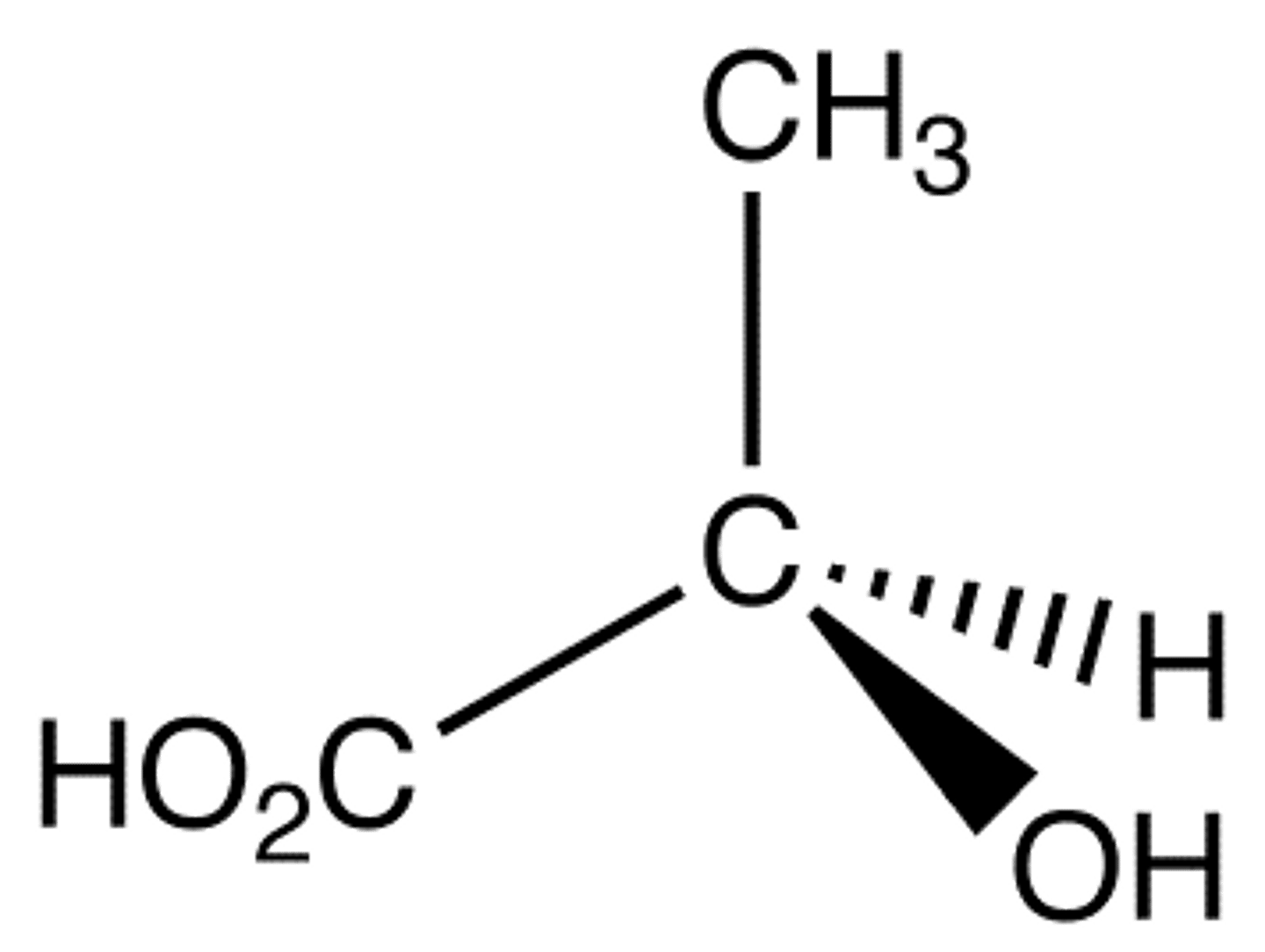 <p>R or S?</p>