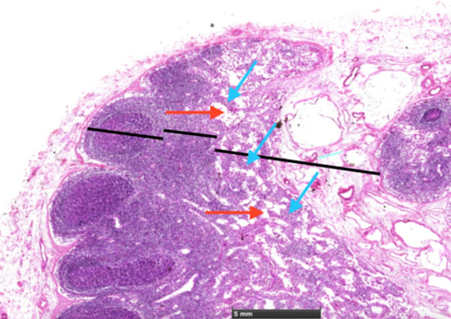 <p>indicated by blue arrows</p>