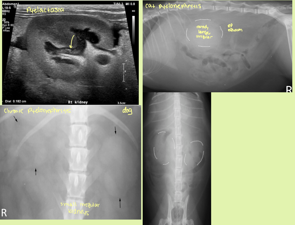 <p>acute</p><ul><li><p>slight enlargement of kidneys ± RP effusion</p></li><li><p>smooth contours and diffusely hyperechoic</p></li><li><p>↓CM distinction</p></li><li><p>pus/echogenic content in pelvis </p></li><li><p>pyelectasia</p></li></ul><p>Chronic</p><ul><li><p>small to normal sized kidneys with irregular shape</p></li><li><p>pelvis distorted</p></li></ul><ul><li><p>↓CM distinction</p></li></ul><p></p>
