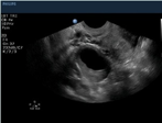 <p>what ovarian phase is this (days included)?</p>