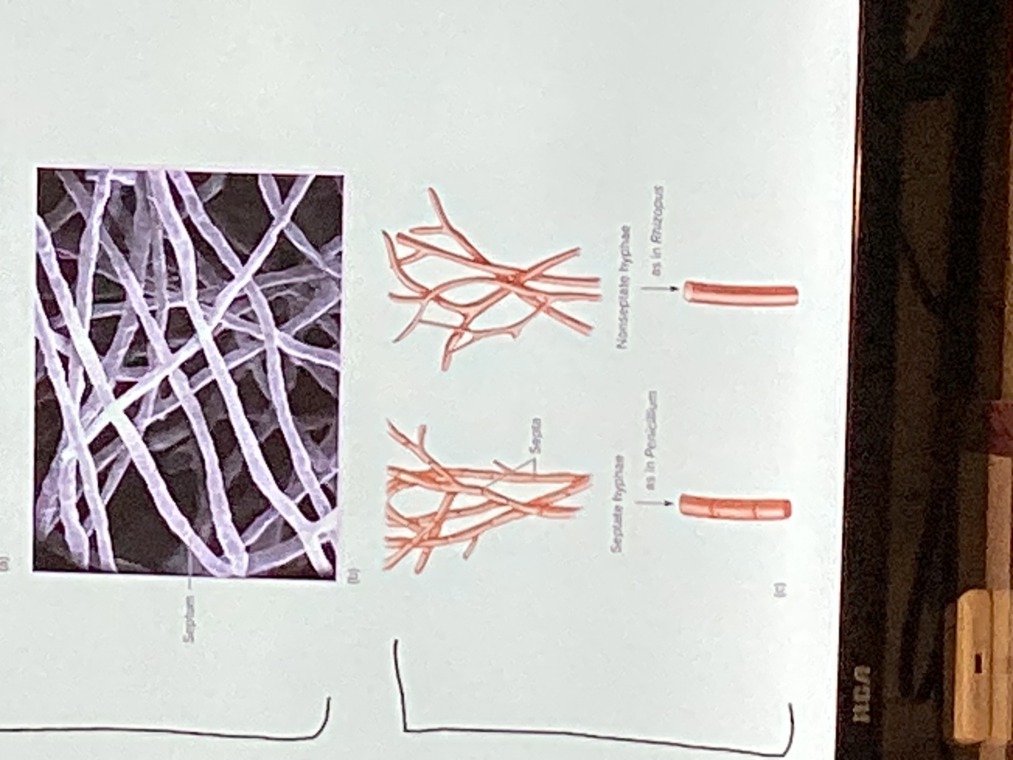<p>Septate hyphae</p>