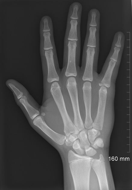 <p>Describe the abnormality demonstrated.</p>