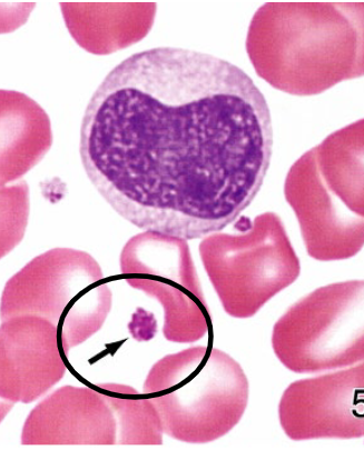<p>what kind of blood cell is this?</p>