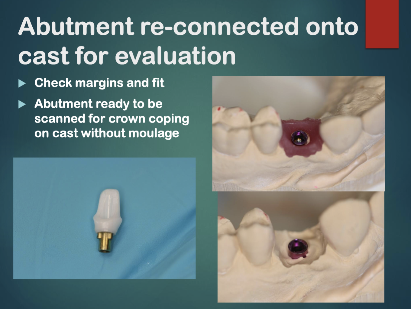 <ol><li><p>wax-up the abutment w ideal emergence profile </p></li><li><p>evaluate wax-up and remove soft tissue moulage </p></li><li><p>re-connect back onto cast without soft tissue moulage for scanning </p></li></ol><p></p>