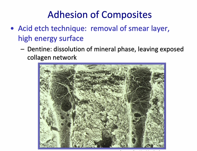 <p>Adhesion of Composites - Acid etch technique - dentine </p>