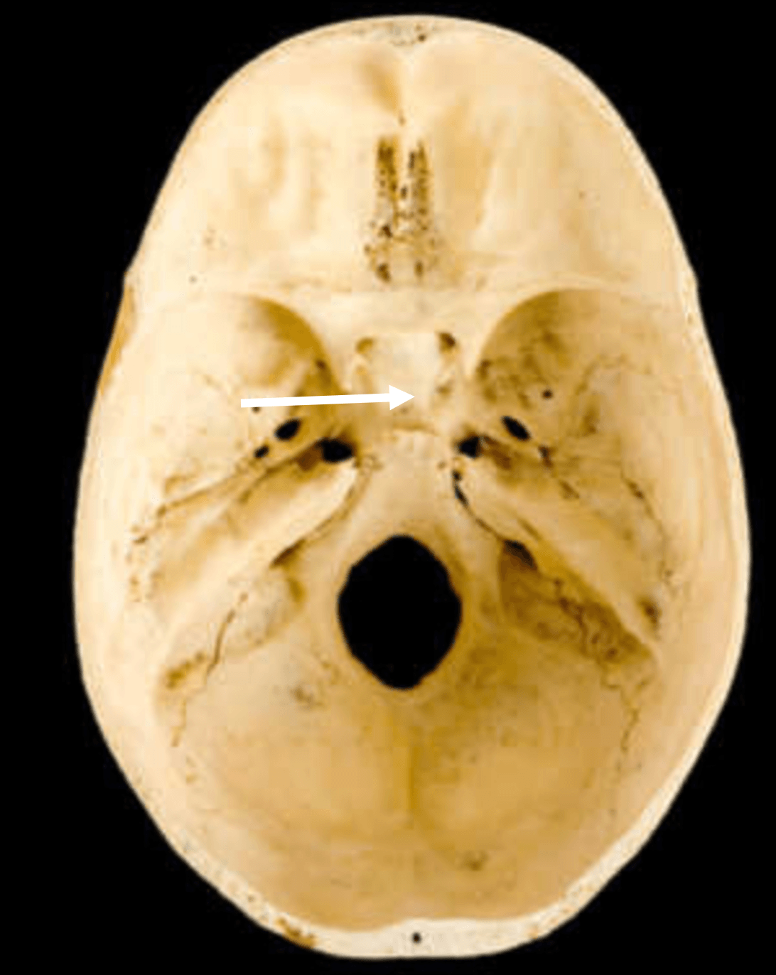 <p>Q. What’s the arrow pointing to?</p>