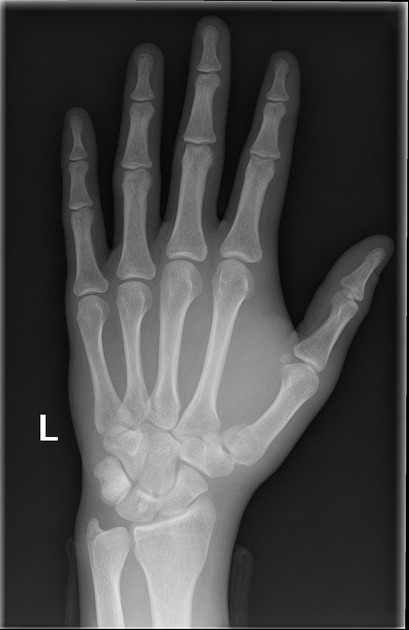 term image