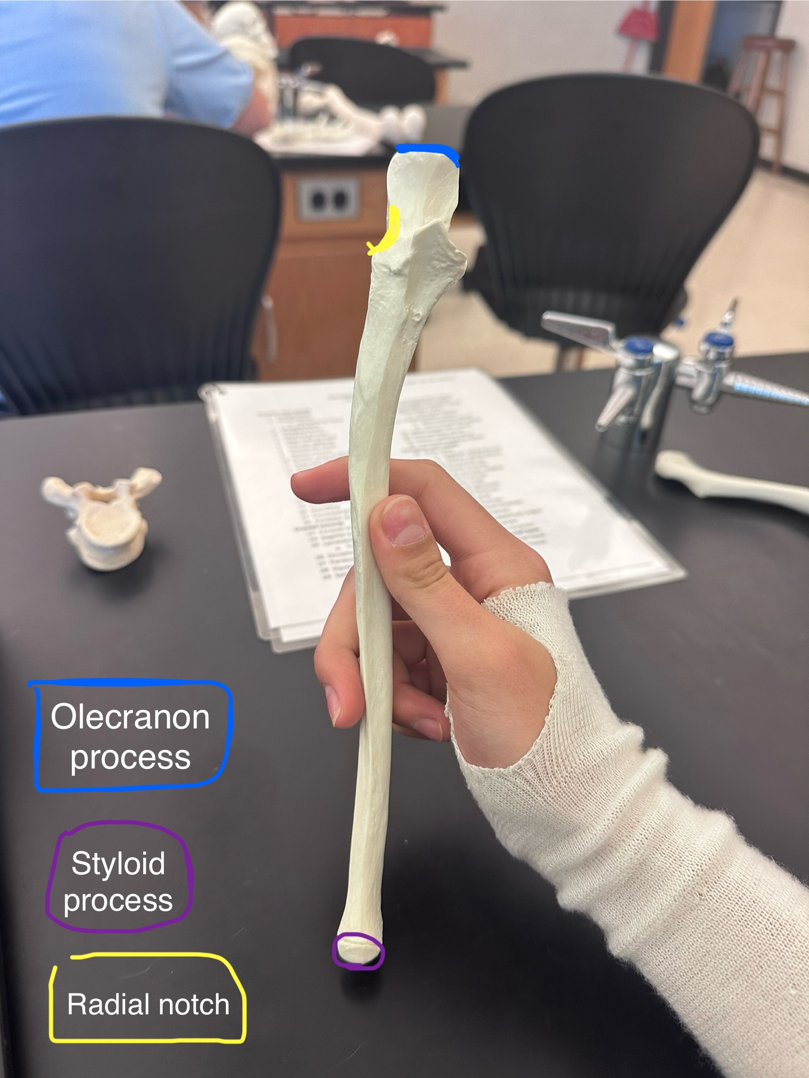 <p>Styloid Process of ulna</p>
