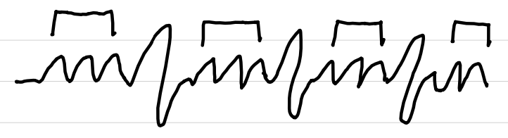 <ul><li><p>rate: <span style="color: red;">atrial 180-400 bpm, ventricular slower</span></p></li><li><p>rhythm: regular</p></li><li><p>P waves: <span style="color: red;">sawtooth, uniform</span></p></li><li><p>PR interval: <span style="color: red;">not measurable</span></p></li><li><p>QRS complexes: <0.10 sec</p></li><li><p>ST segments: <span style="color: red;">may not be seen</span></p></li></ul><p></p>